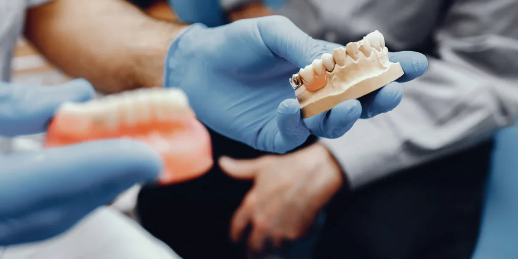 Dental Implants vs Bridges: Which Is the Better Long-Term Solution?