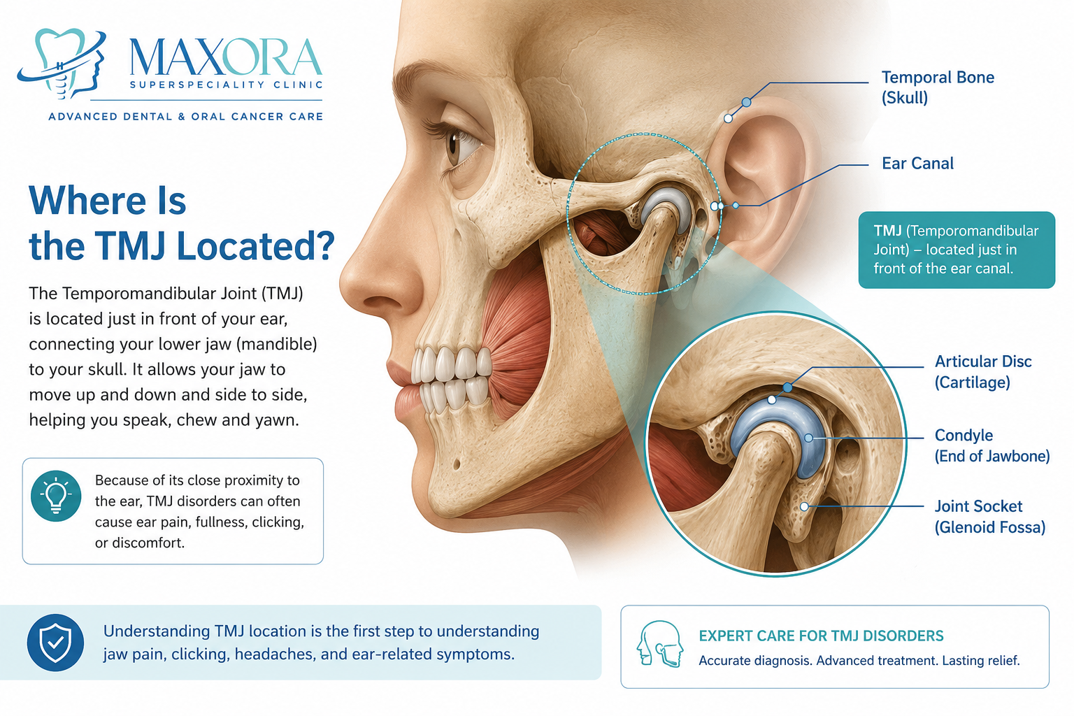 Detailed TMJ anatomy illustration showing the temporomandibular joint located just in front of the ear canal, including the articular disc, condyle, and joint socket.