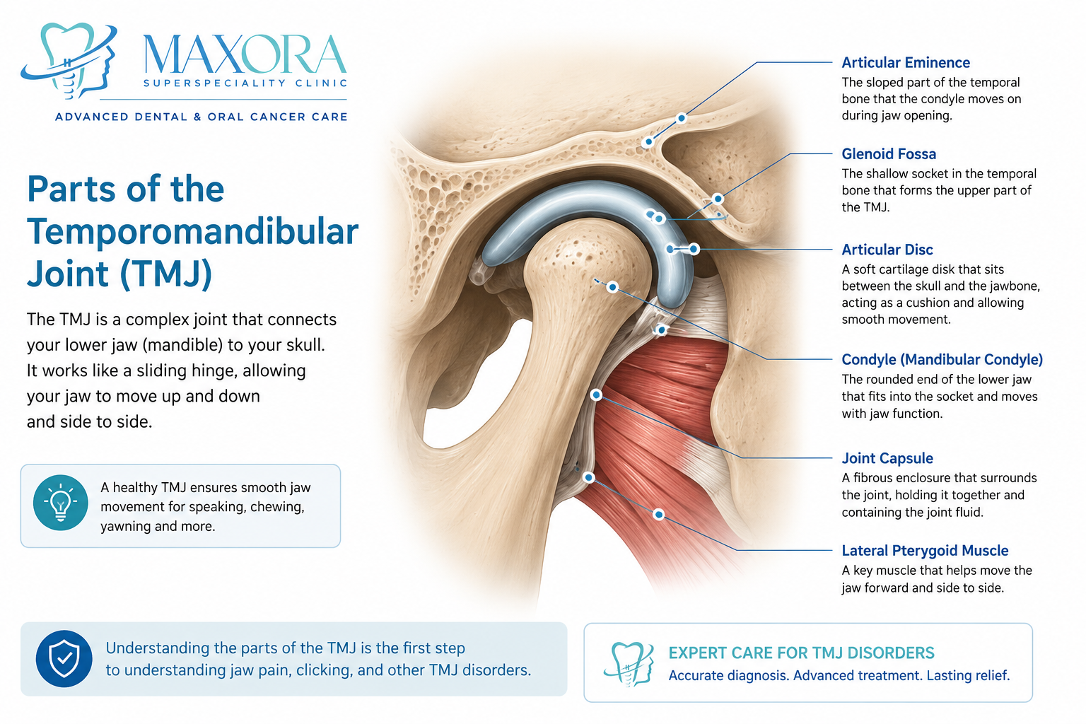 Detailed TMJ anatomy illustration showing the articular eminence, glenoid fossa, articular disc, mandibular condyle, joint capsule, and lateral pterygoid muscle.