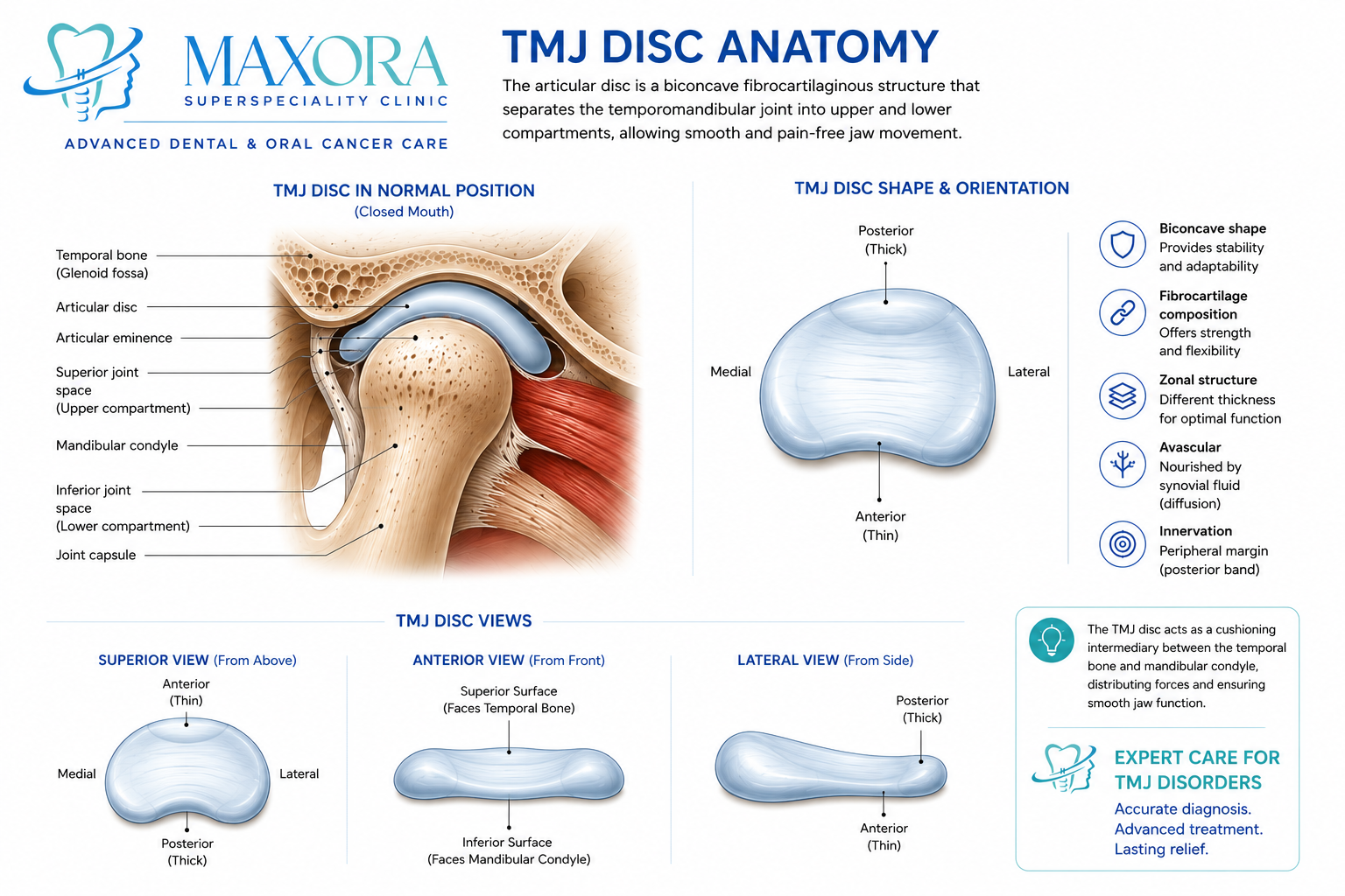 Detailed anatomical illustration of the temporomandibular joint (TMJ) disc showing its biconcave fibrocartilaginous structure, anterior and posterior bands, superior and inferior joint spaces, and relationship to the mandibular condyle and temporal bone.